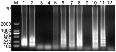 Development of a visual detection method of porcine deltacoronavirus using loop-mediated isothermal amplification